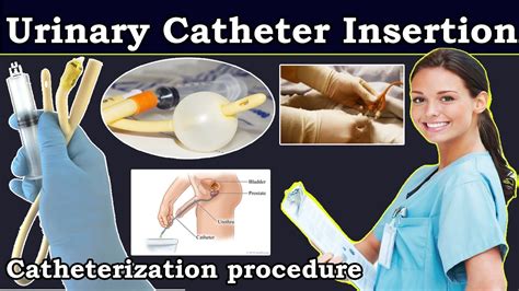 catheter porn|Catheter Insertion Porn Videos .